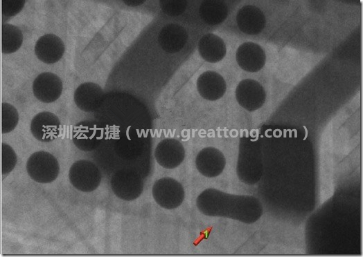 BGA因?yàn)楹笁|變小，造成錫膏過(guò)多而最終形成焊接短路的結(jié)果。